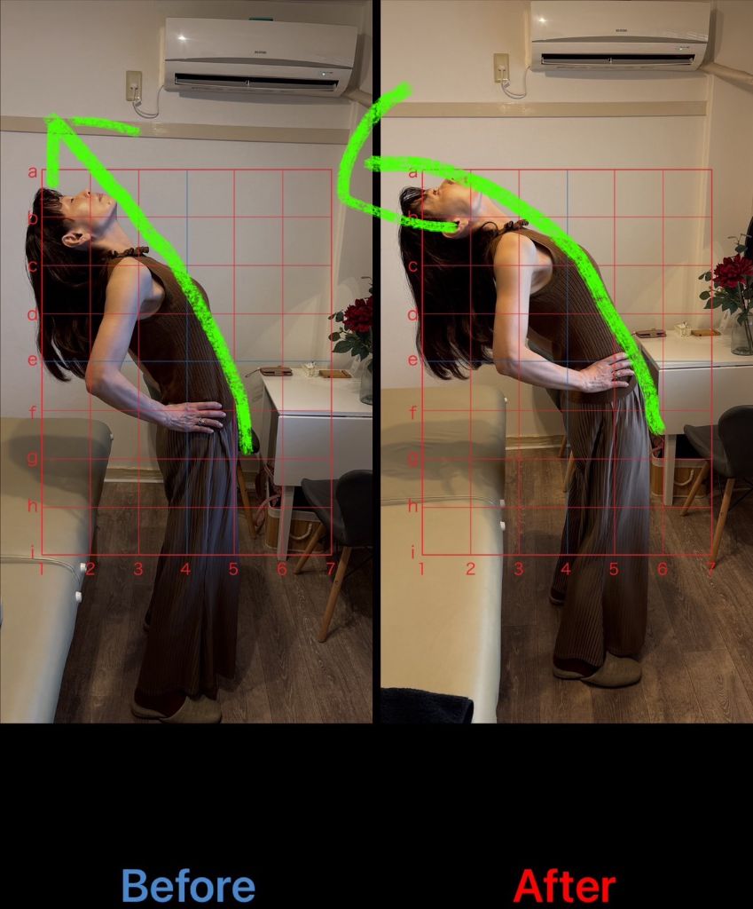 姿勢改善 施術結果5