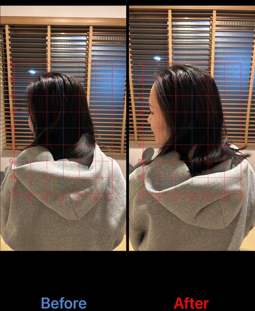 姿勢改善 施術結果23